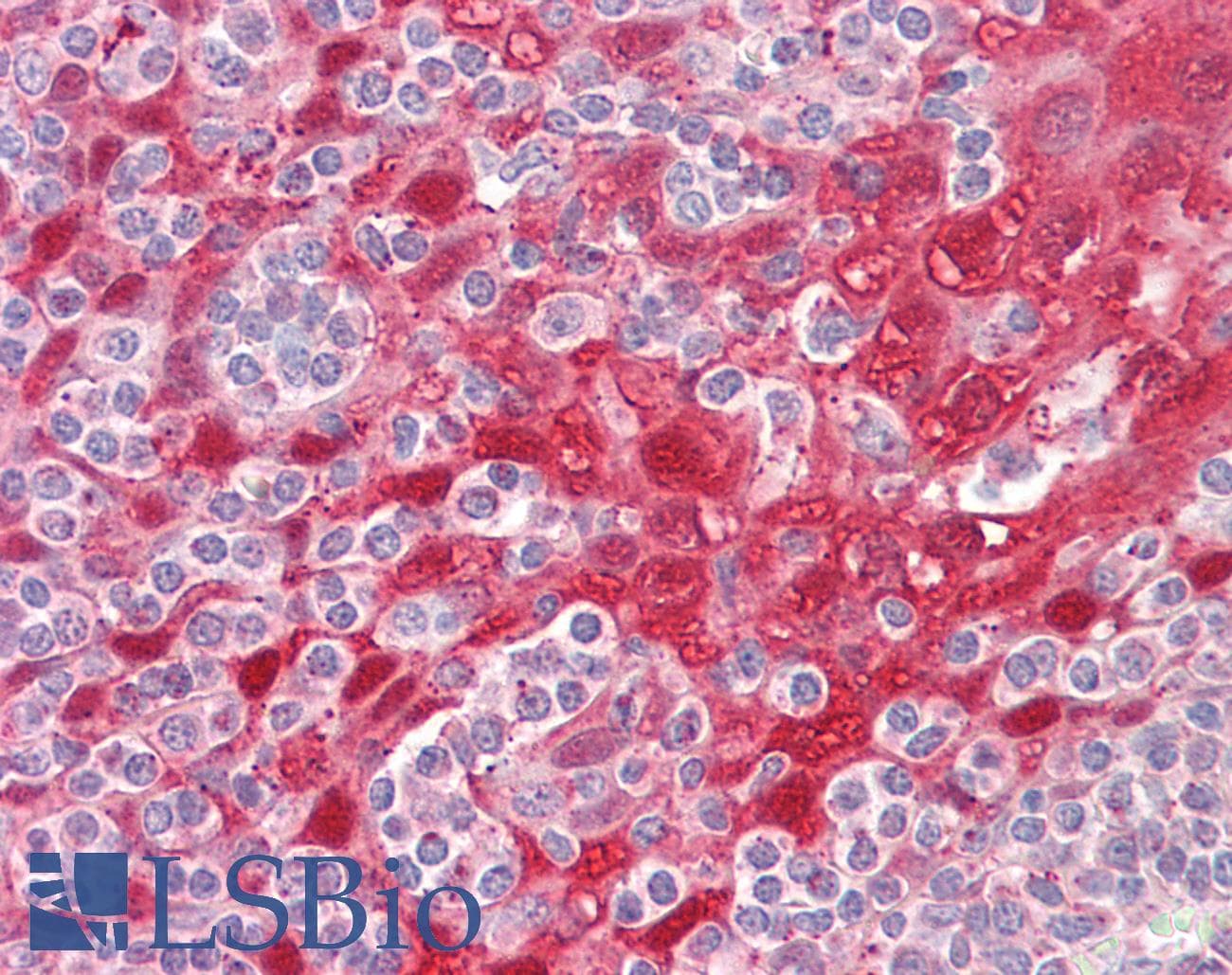 IHC-plus™ Polyclonal Rabbit anti-Human CSTA / Cystatin A Antibody (aa49-98, IHC, IF, WB)