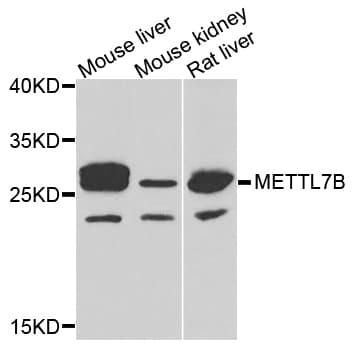 METTL7B Antibody