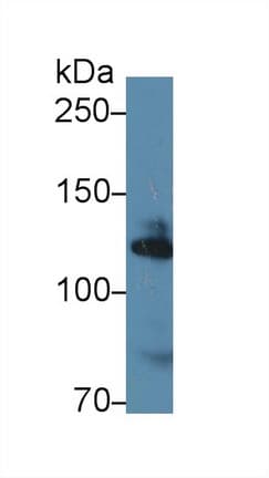ADD1 / Adducin Alpha Antibody (aa388-560)