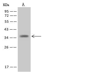 Polyclonal Rabbit anti-Human NUDT22 Antibody (WB)
