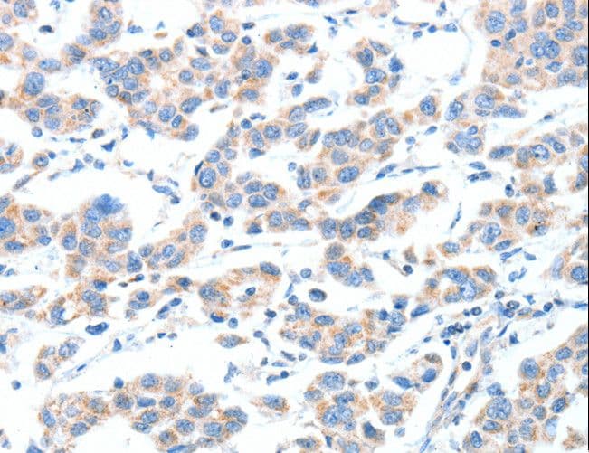 XBP1 Antibody