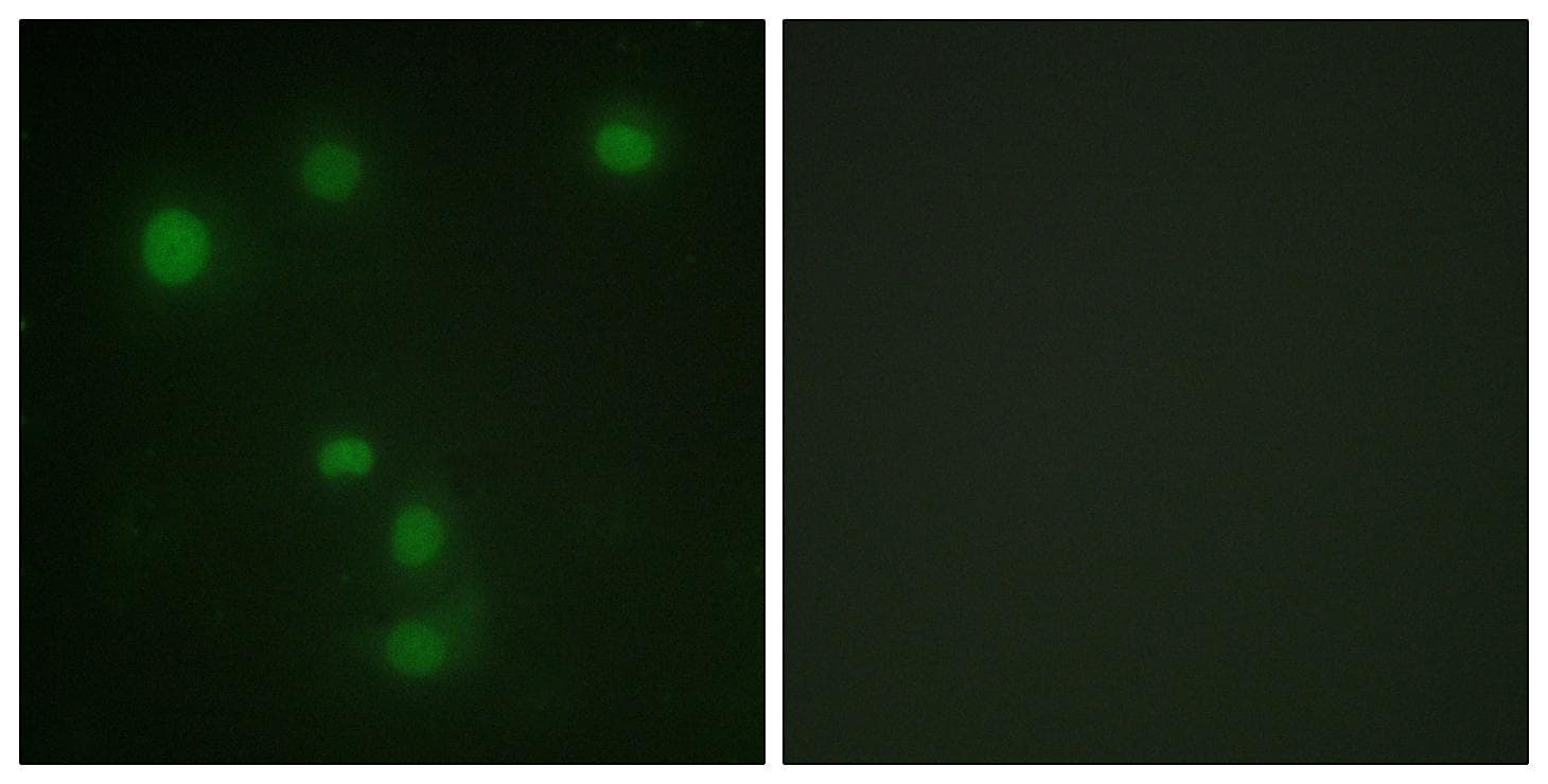 Polyclonal Rabbit anti-Human RB1 / Retinoblastoma / RB Antibody (Ab-826, IHC, IF)