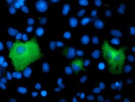 PSMD2 Antibody (clone OTI1B4)