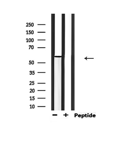 Polyclonal Rabbit anti-Human PAK1 Antibody (phospho-Thr212, IHC, IF, WB)