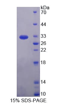 Rat IL17RD Protein (Recombinant His-T7)