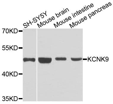 Polyclonal Rabbit anti-Human KCNK9 / TASK3 Antibody (WB)