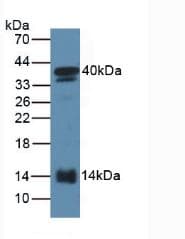 SAA2 / Serum Amyloid A2 Antibody (aa20-122)