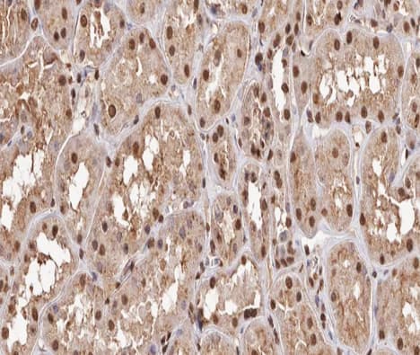 Polyclonal Rabbit anti-Human RELA / NFKB p65 Antibody (phospho-Thr254, IHC, IF, WB)