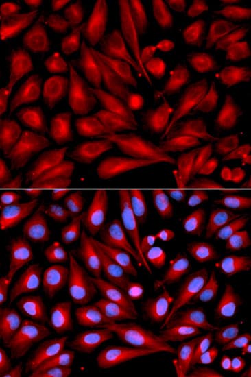 Polyclonal Rabbit anti-Human MAP2K7 / MEK7 Antibody (IHC, IF, WB)