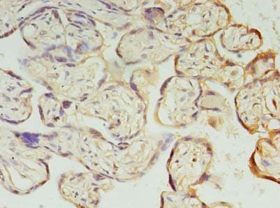 Polyclonal Rabbit anti-Human PIH1D1 Antibody (IHC, WB)