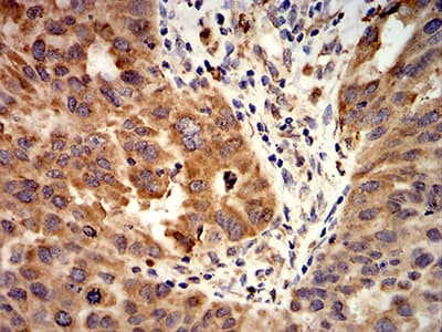 Monoclonal Mouse anti-Human ALK2 / ACVR1 Antibody (clone 2E2C11, IHC, WB)