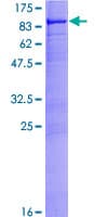Human MYLK2 Protein (Recombinant GST)