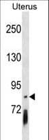PCDHGB4 Antibody (aa353-379)