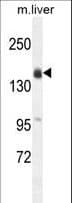 Polyclonal Rabbit anti-Human OTOA Antibody (aa92-120, IHC, WB)