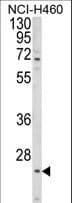 ALG14 Antibody (aa67-93)