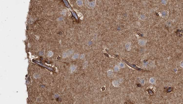 Polyclonal Rabbit anti-Human GCK / Germinal Center Kinase Antibody (IHC, WB)