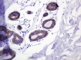 CTNND1 / p120 Catenin Antibody (clone OTI2E8)
