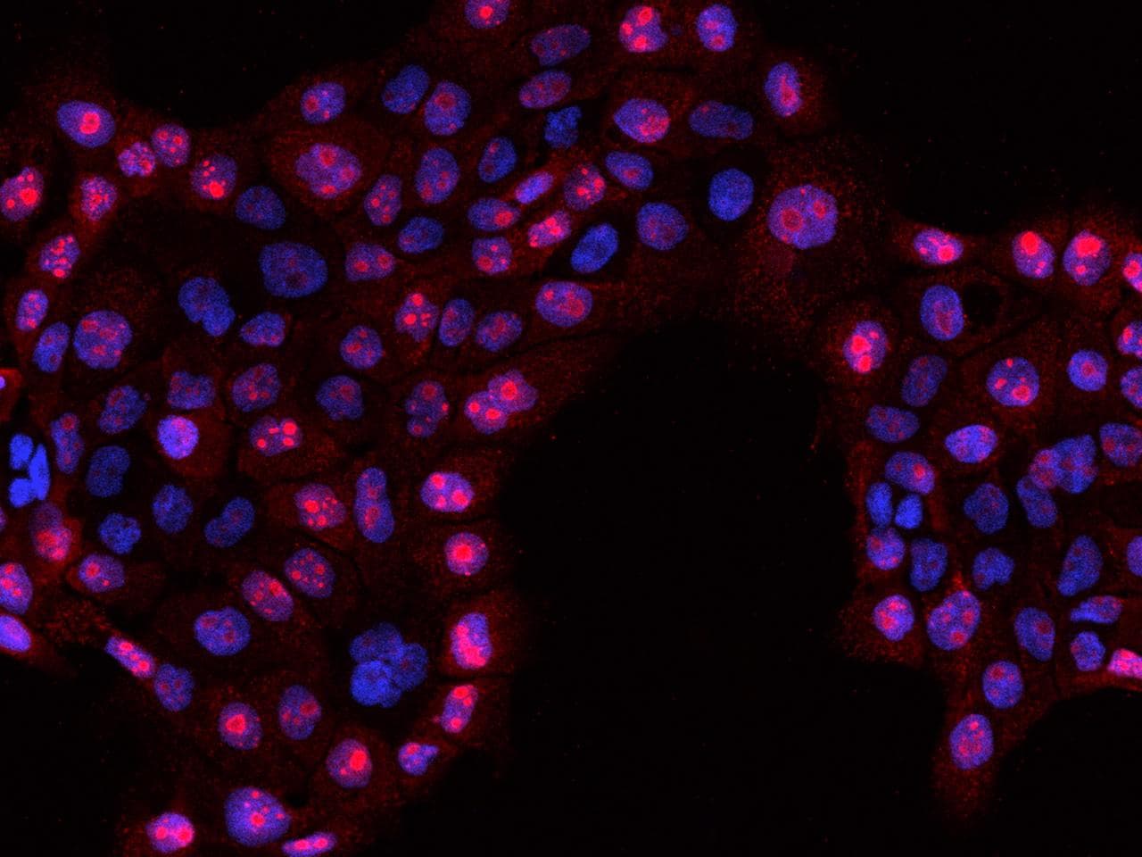 Polyclonal Rabbit anti-Human RSL1D1 Antibody (IF)