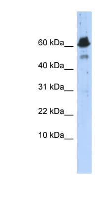 ABAT Antibody (aa179-228)