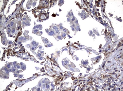 SDCBP / Syntenin Antibody (clone UMAB69, Carrier-free)