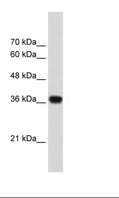 PSIP1 / LEDGF Antibody (aa85-134)