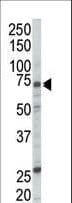 Polyclonal Rabbit anti-Human RAF1 / RAF Antibody (aa1-30, IHC, IF, WB)