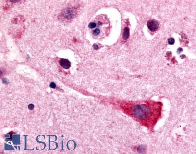 IHC-plus™ GPR17 Antibody (N-Terminus)