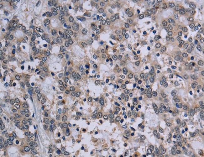 TP53AIP1 / p53 AIP1 Antibody