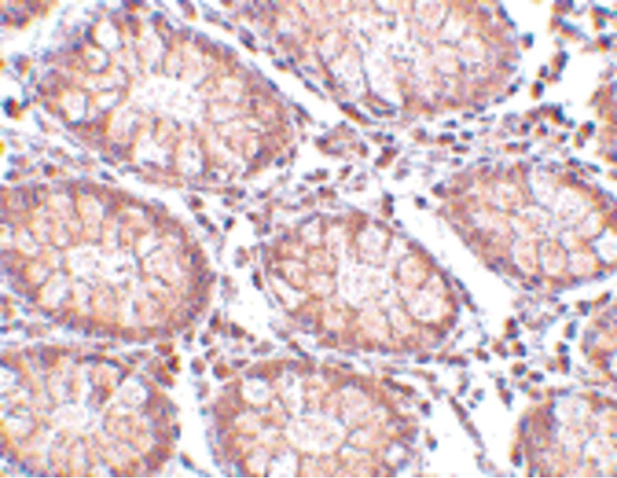 CCK4 / PTK7 Antibody