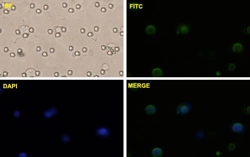 CTNNB1 / Beta Catenin Antibody (clone 1C9)