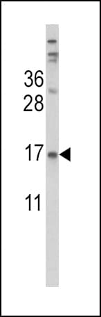 TTR / Transthyretin Antibody (aa47-74)