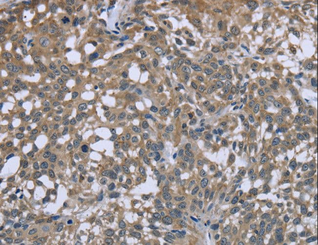 PTK2B / PYK2 Antibody