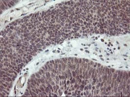 PDLIM2 / SLIM Antibody (clone OTI3B5)