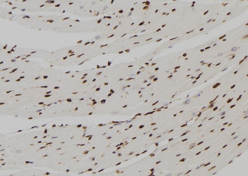 FBP1 Antibody