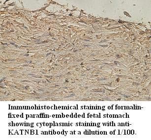 KATNB1 Antibody (aa429-578)