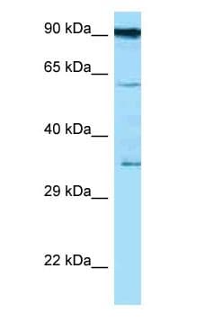 CD82 Antibody (aa141-190)