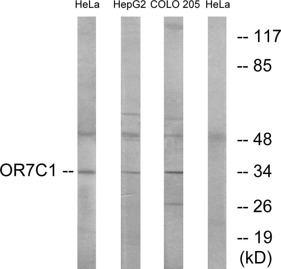 IHC-plus™ OR7C1 Antibody (aa199-248)
