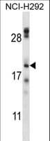 TMEM17 Antibody (aa6-35)
