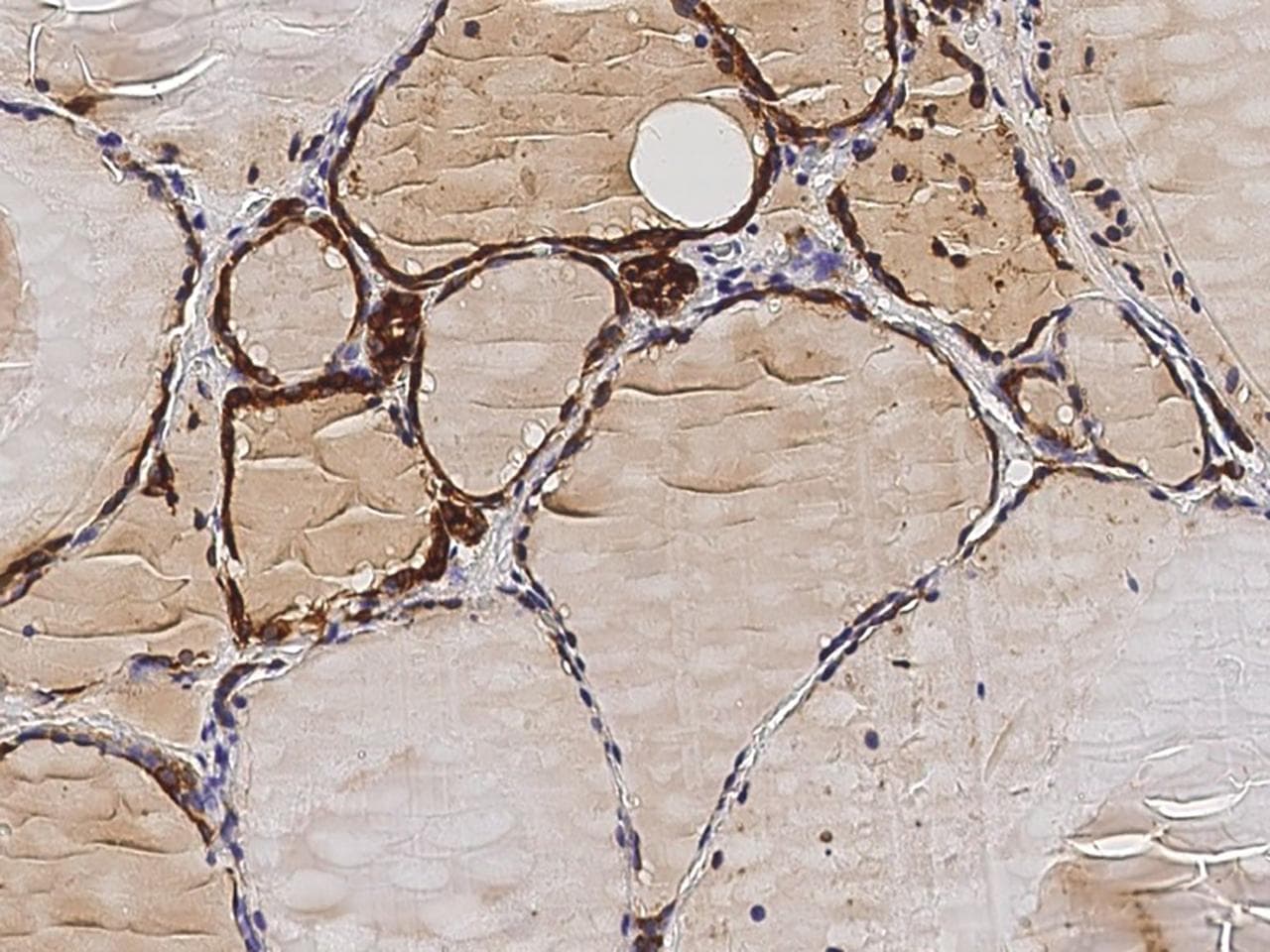 Monoclonal Mouse anti-Human TPO / Thyroid Peroxidase Antibody (clone 17, Preservative Free, IHC)