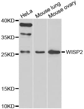 Polyclonal Rabbit anti-Human CCN5 Antibody (IHC, WB)