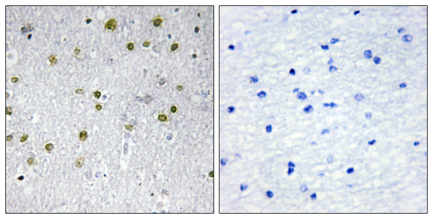 Polyclonal Rabbit anti-Human NRIP2 Antibody (aa1-50, IHC)