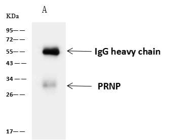 PRNP / PrP / Prion Antibody