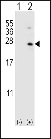 Polyclonal Rabbit anti-Human HPRT1 / HPRT Antibody (aa150-178, IHC, WB)