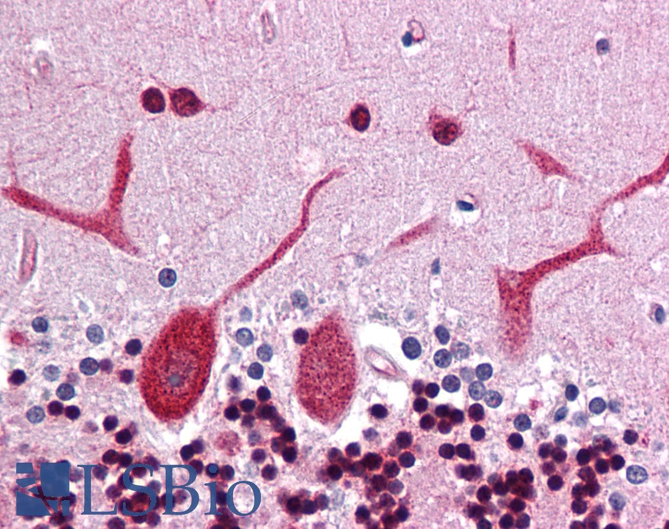 IHC-plus™ Polyclonal Rabbit anti-Human DCLK3 / CLR Antibody (IHC, IF, WB)