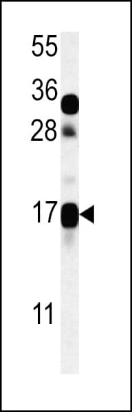 TRAG3 / CSAG2 Antibody (aa1-30)