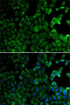 Polyclonal Rabbit anti-Human MSR1 / CD204 Antibody (IF, WB)