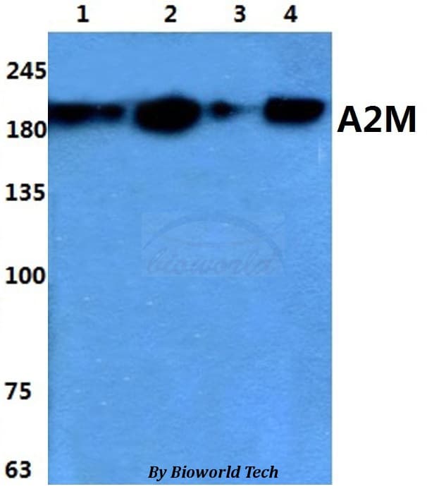 A2M / Alpha-2-Macroglobulin Antibody
