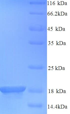 Mouse BIRC5 / Survivin Protein (Recombinant 6His, N-terminus)