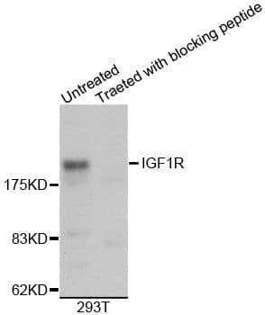 Polyclonal Rabbit anti-Human IGF1R / IGF1 Receptor Antibody (IHC, IF, WB)