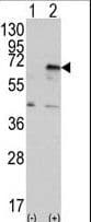 EIF2AK2 / PKR Antibody (aa519-550)